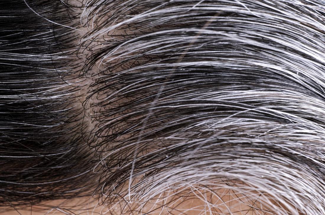 white_hair.jpg